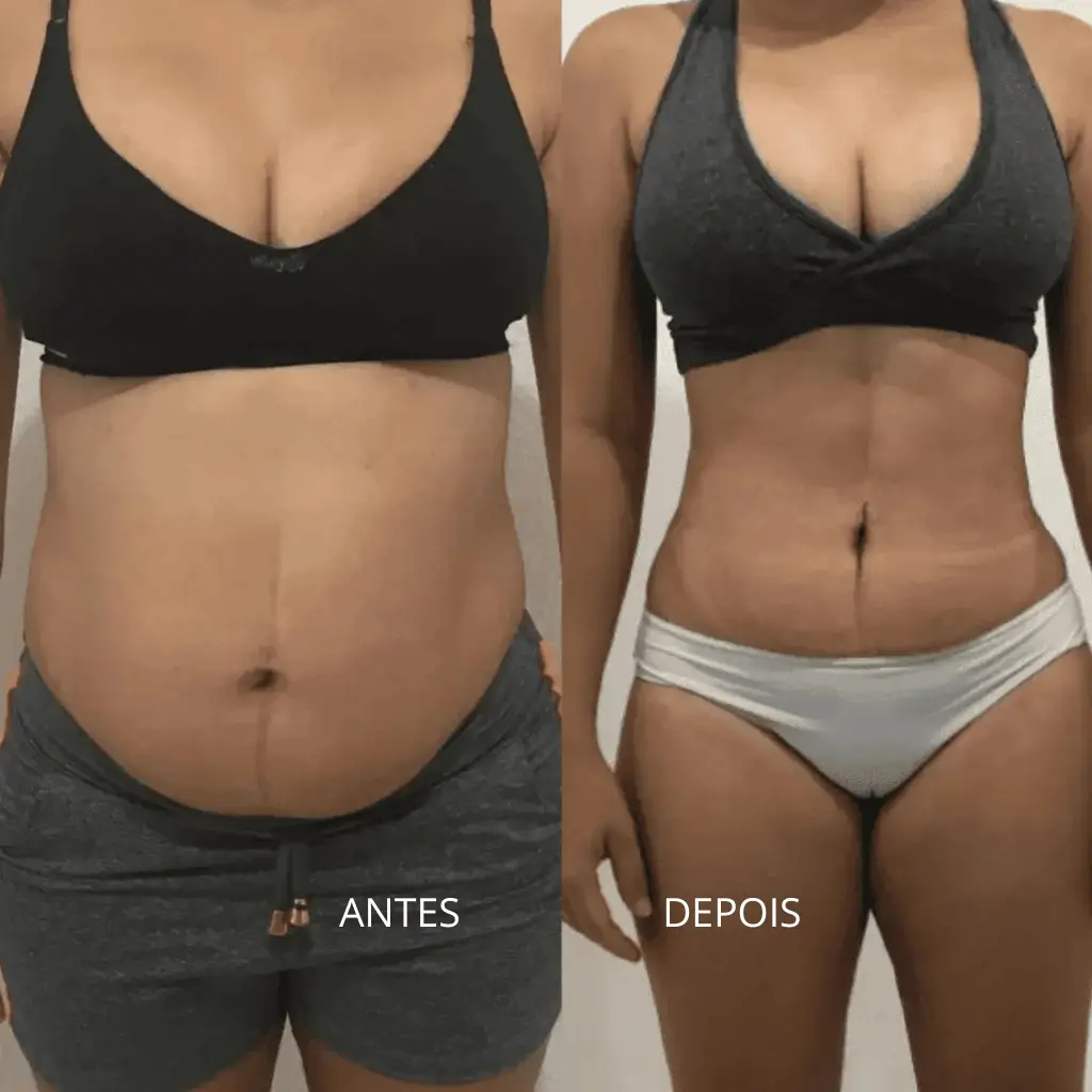 ANTES (2