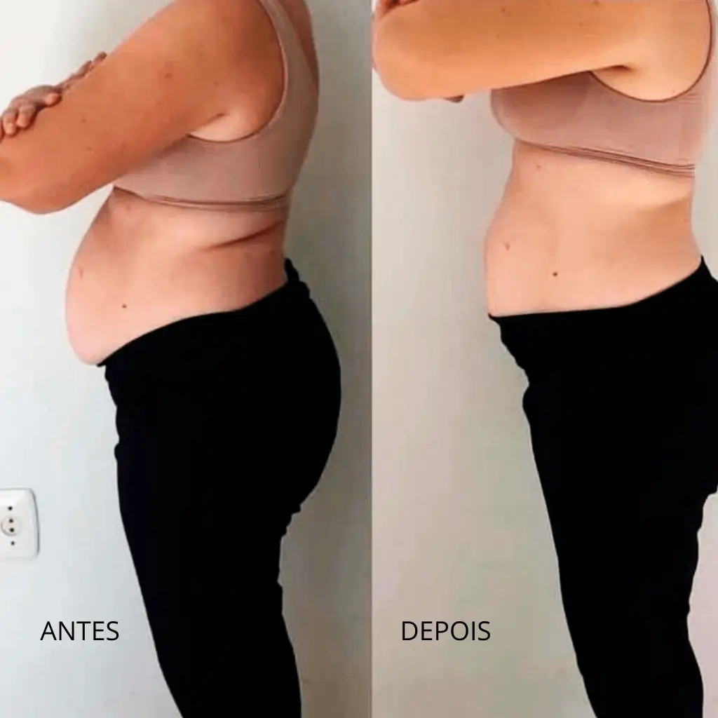 ANTES 5
